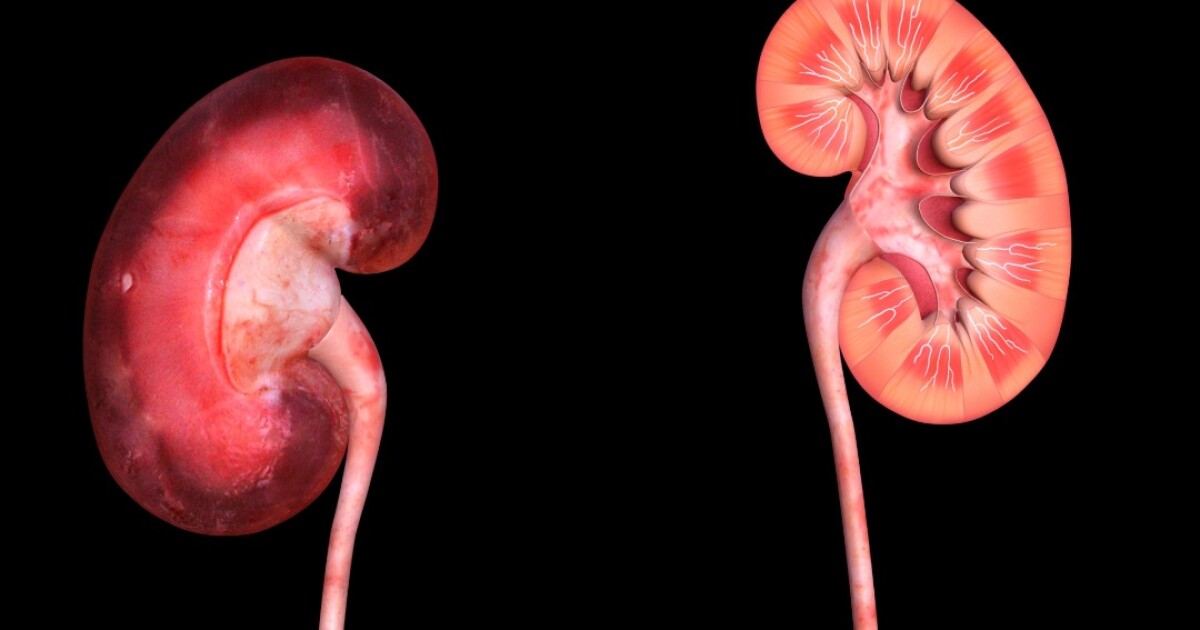 Infected kidneys save lives