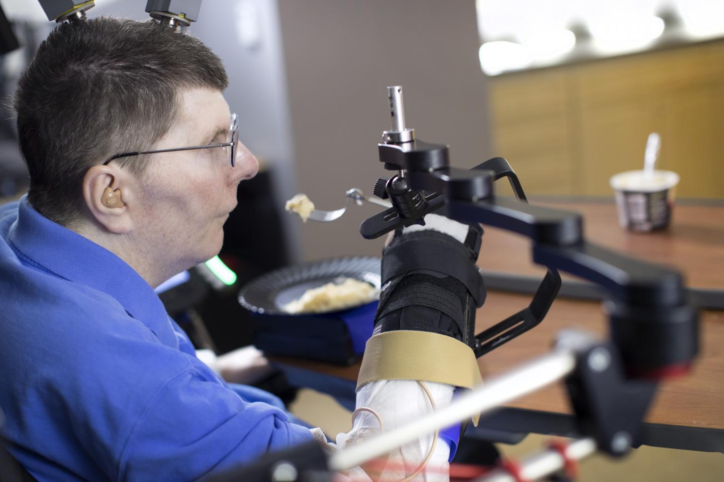 Implants link paralyzed man's arm to his brain to restore movement