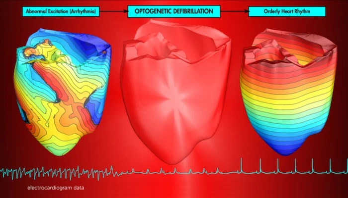 Scientists have found, in tests on mice and simulated human hearts, that administering painless pulses of light to correct irregular heart beats might be a viable alternative to harsh electric shocks