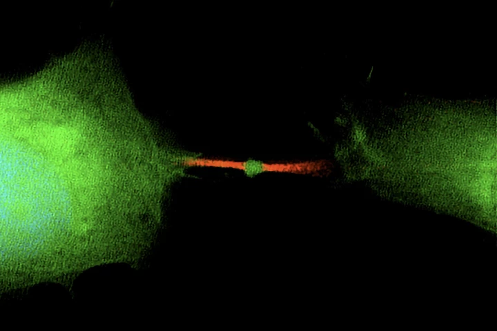 A study has found that the midbody (tiny green dot in the center) left over after cells divide could be a vehicle for the spread of cancer