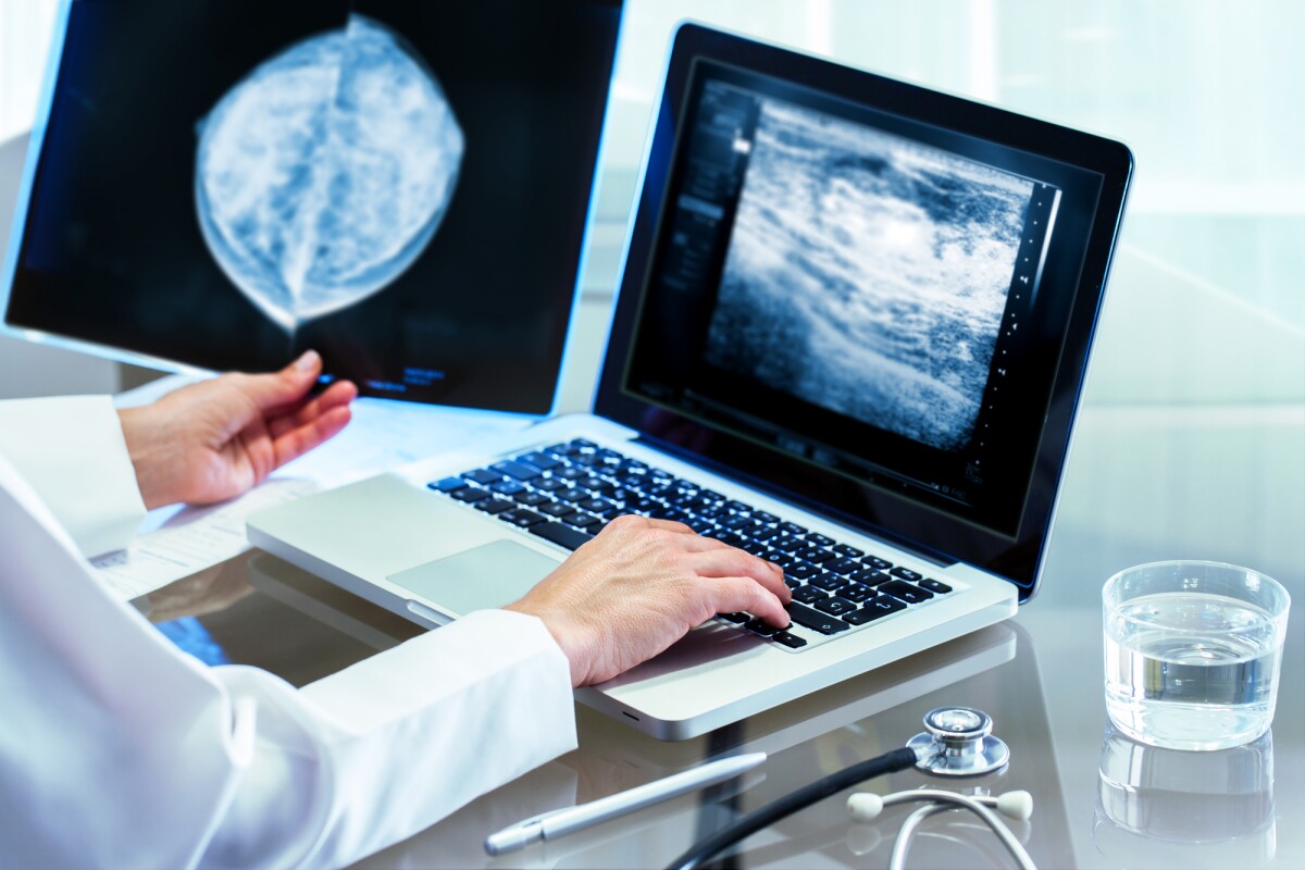 AI-Support Mammogram Screening Increases Breast Cancer Detection