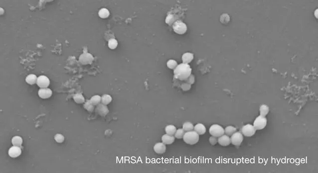 Only a few bacteria are left over, after the hydrogel was used to destroy a solid bacterial biofilm