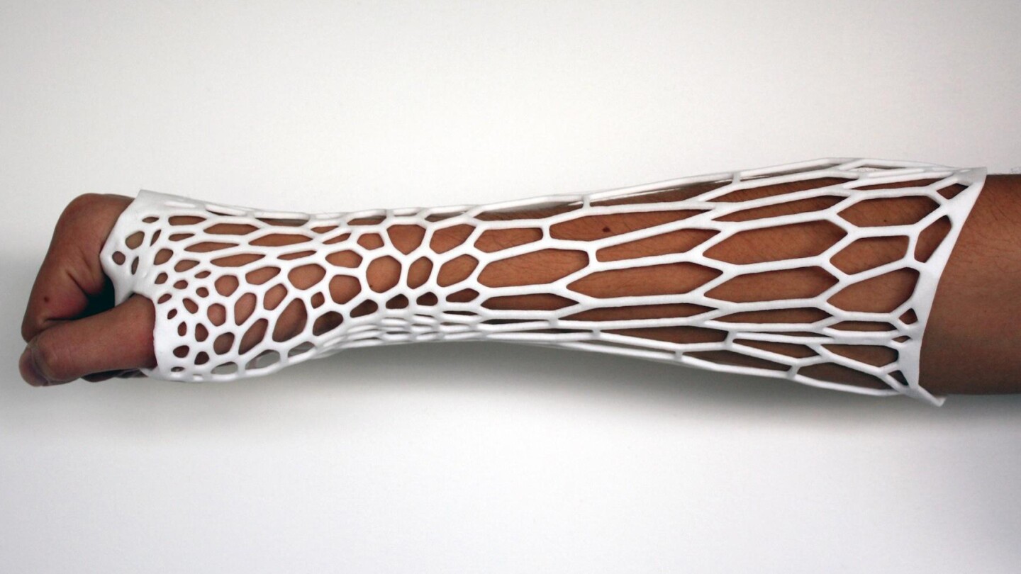 The cortex is a 3D-printed plastic cast designed to replace the traditional bulky plaster casts