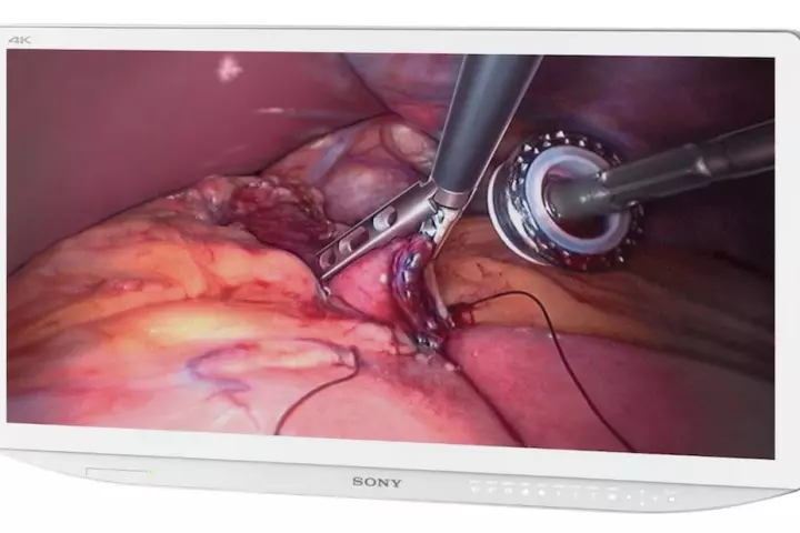 Sony has unveiled a new line of medical monitors and recorders, including the first to combine 3D imagery with 4K resolution