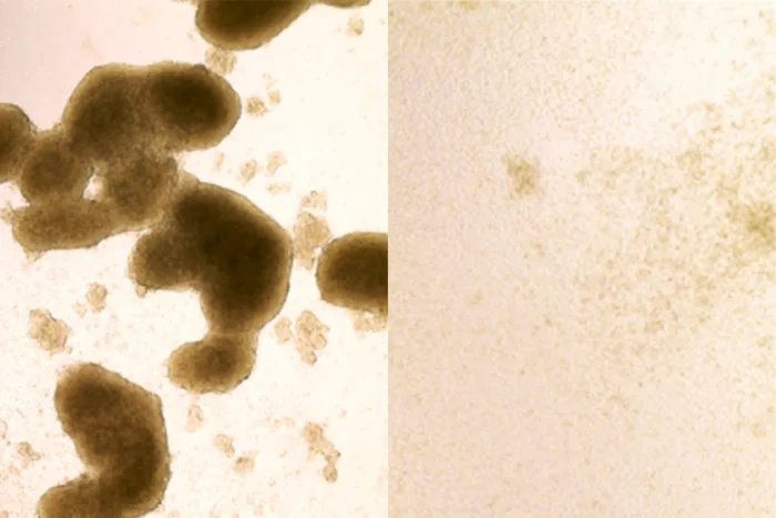 On the left are the brain cancer cells before being treated with the Zika virus and on the right is after the treatment