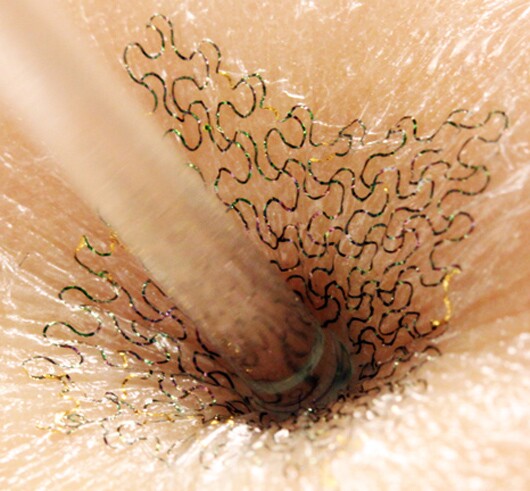 The circuits' filamentary serpentine shape allows them to bend, twist, scrunch and stretch while maintaining functionality (Image: John Rogers)