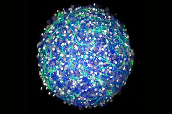 A representation of the sphere of central nervous system tissue, or "mini brain", developed by researchers at Brown University