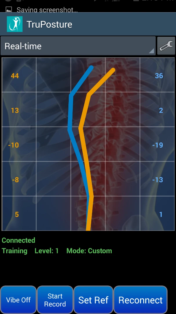The TruPosture mobile app shows a real-time graphical representation of spine alignment