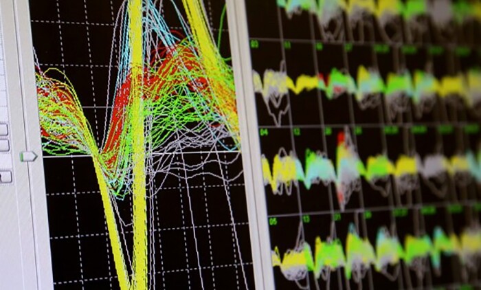 A computer in the lab of Miguel Nicolelis, M.D., Ph.D., monitors brain signals from a rhesus macaque. Nicolelis and Duke researchers record signals from hundreds of neurons in two regions of the monkeys’ brains that are involved in movement and sensation
