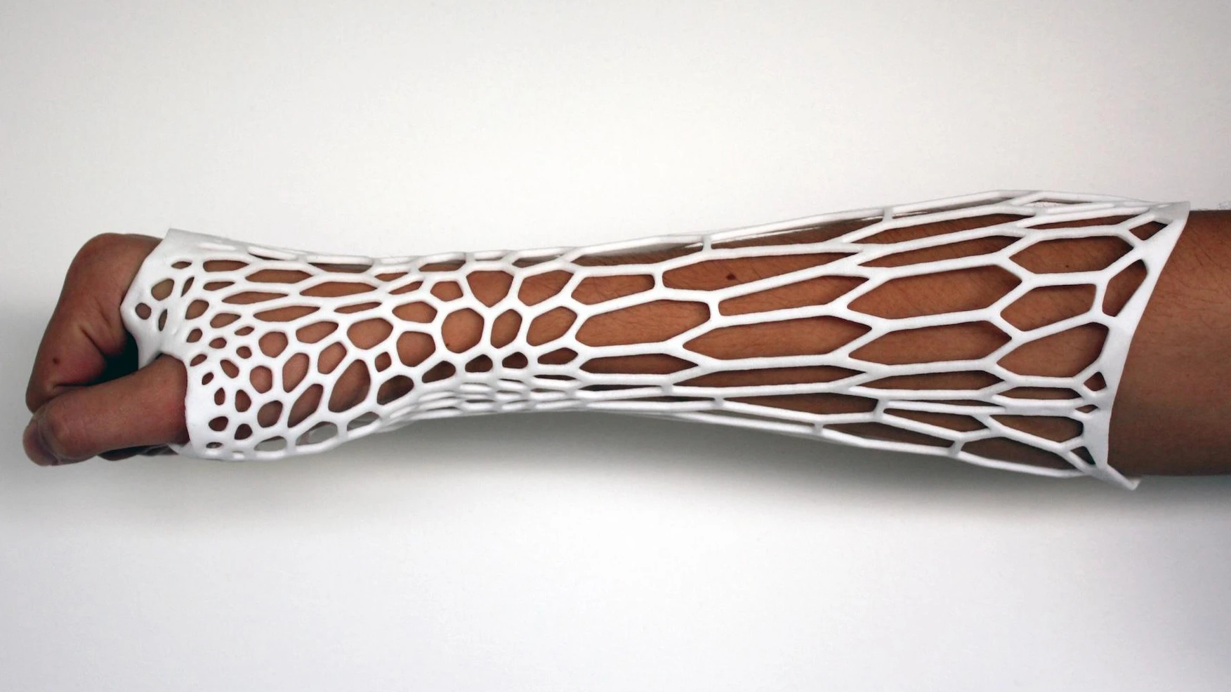 The cortex is a 3D-printed plastic cast designed to replace the traditional bulky plaster casts