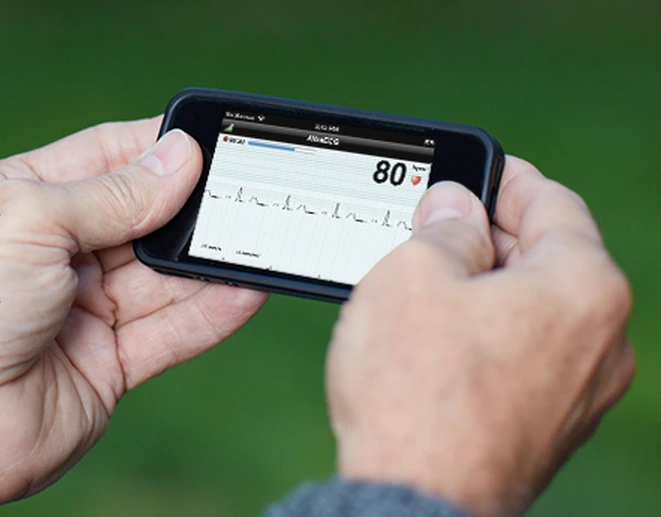 The AliveCor Heart Monitor attaches to the back of an iPhone 4 or 4S
