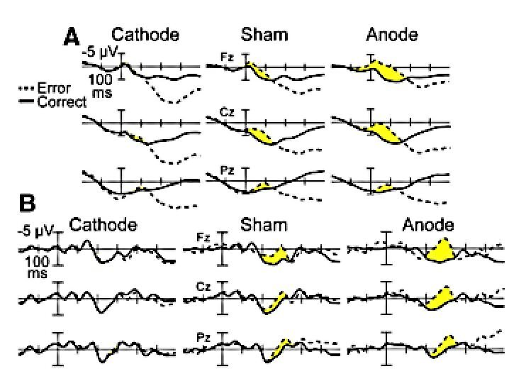 The changes in ERN and FRN components of the event-reaction potential during the Vanderbilt study experiments (Image: Robert Reinhart/Vanderbilt)
