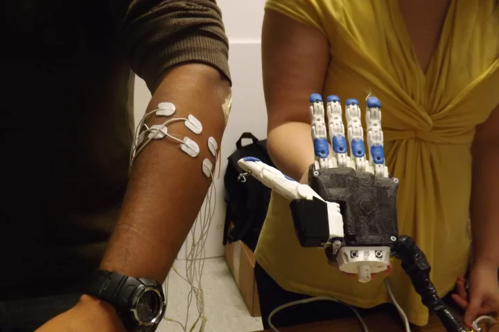 A US$270 programmable, 3D-printed electromyographic prosthetic hand may soon change the lives of amputees in Ecuador and elsewhere around the world (Photo: University of Illinois at Urbana-Champaign)