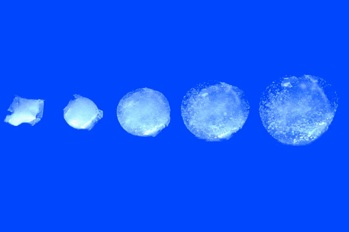 The pill has the potential to keep track of stomach health using a variety of sensors