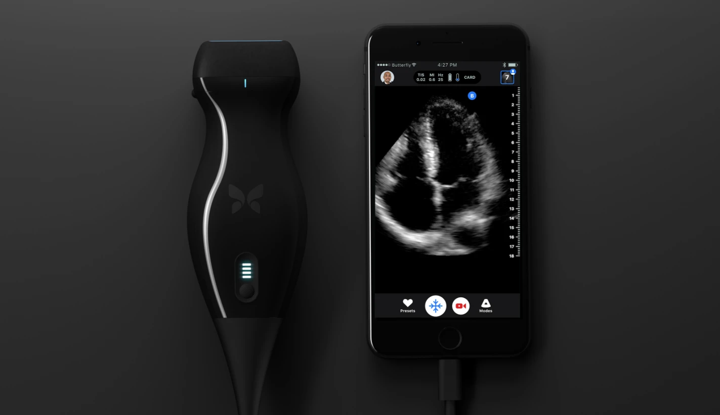 The portable ultrasound device is the size of a electric shaver
