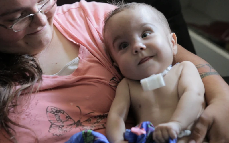 Kaiba Gionfriddo, seen here with a ventilator attachment, is the recipient of a first-of-its-kind tracheal splint