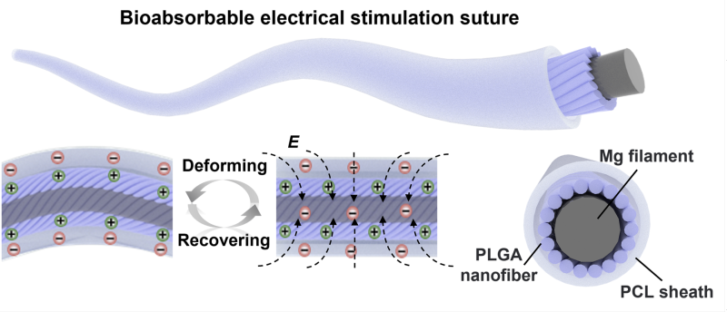 Diagrama ilustrativo de una sutura de estimulación eléctrica bioabsorbible. La imagen muestra un diseño detallado con capas y componentes, incluyendo un filamento de magnesio (Mg filament), una nanofibra de PLGA y una cubierta de PCL. Se destacan procesos de deformación y recuperación que generan carga eléctrica, representados con símbolos de cargas positivas y negativas.