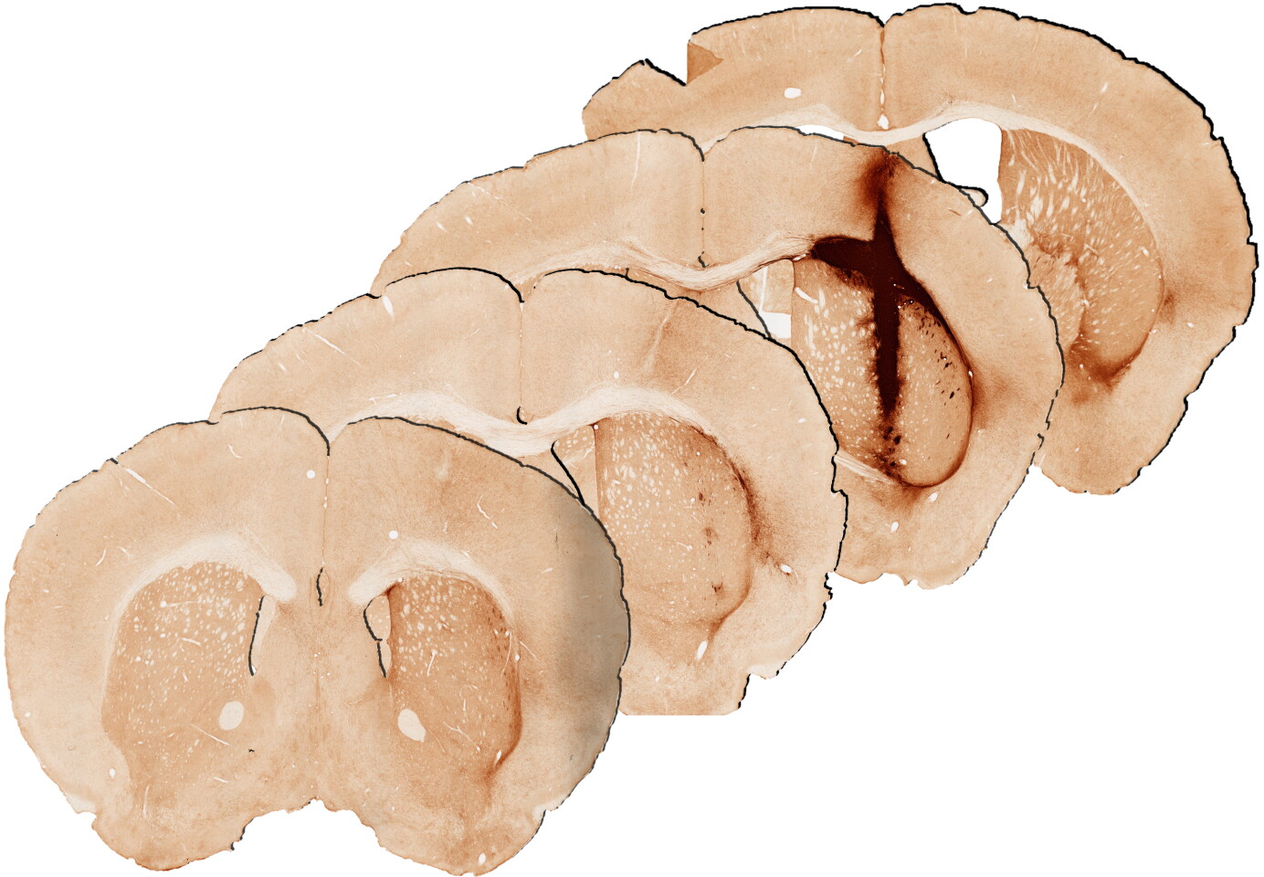 Effect of hydrogel containing myoglobin in mouse brain after 28 days