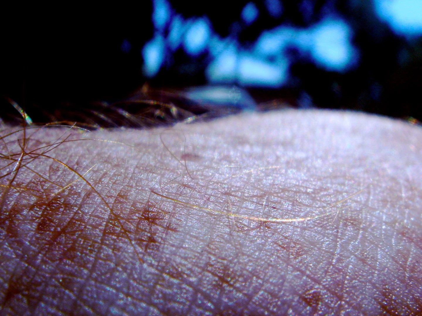 The device images not just the skin itself, but also structures below its surface