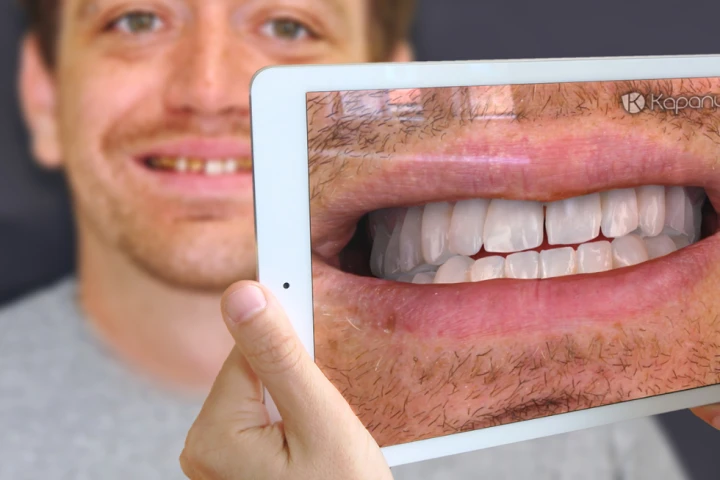 Kapanu actually showed off its augmented reality software at the International Dental Show in Germany earlier this year