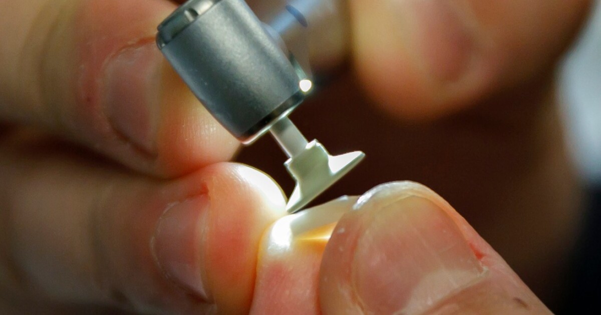 New tooth tech shows promise for stronger, longerlived fillings