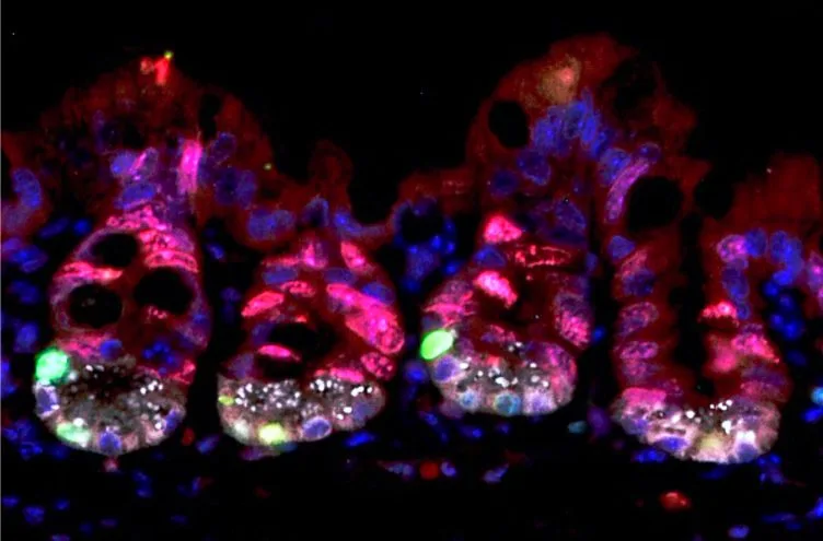 The red cells are proliferating cells in the intestinal crypts, which are vulnerable to radiation damage. The green ones however are dormant and have high levels of URI, protecting them from damage