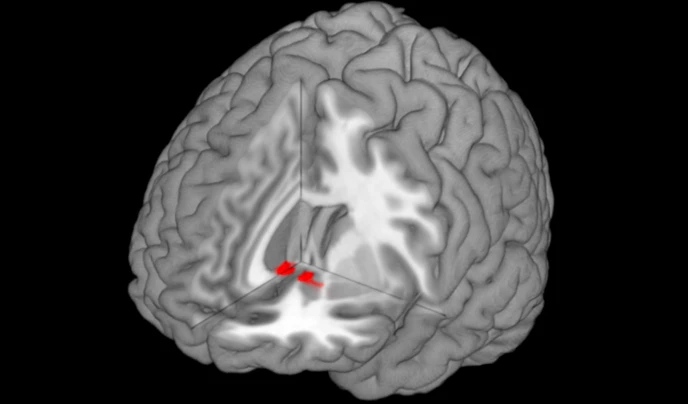 Close neurological ties between reward-processing and pain-processing regions in the brain may allow love to provide effective pain relief (Image: Chris Rorden, rendered with MRIcroGL)