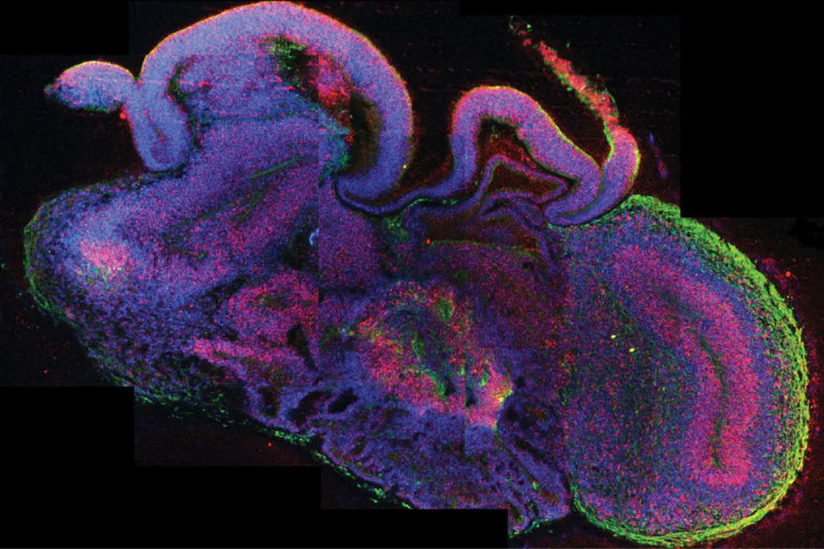 A cross section of one of the "mini brains"