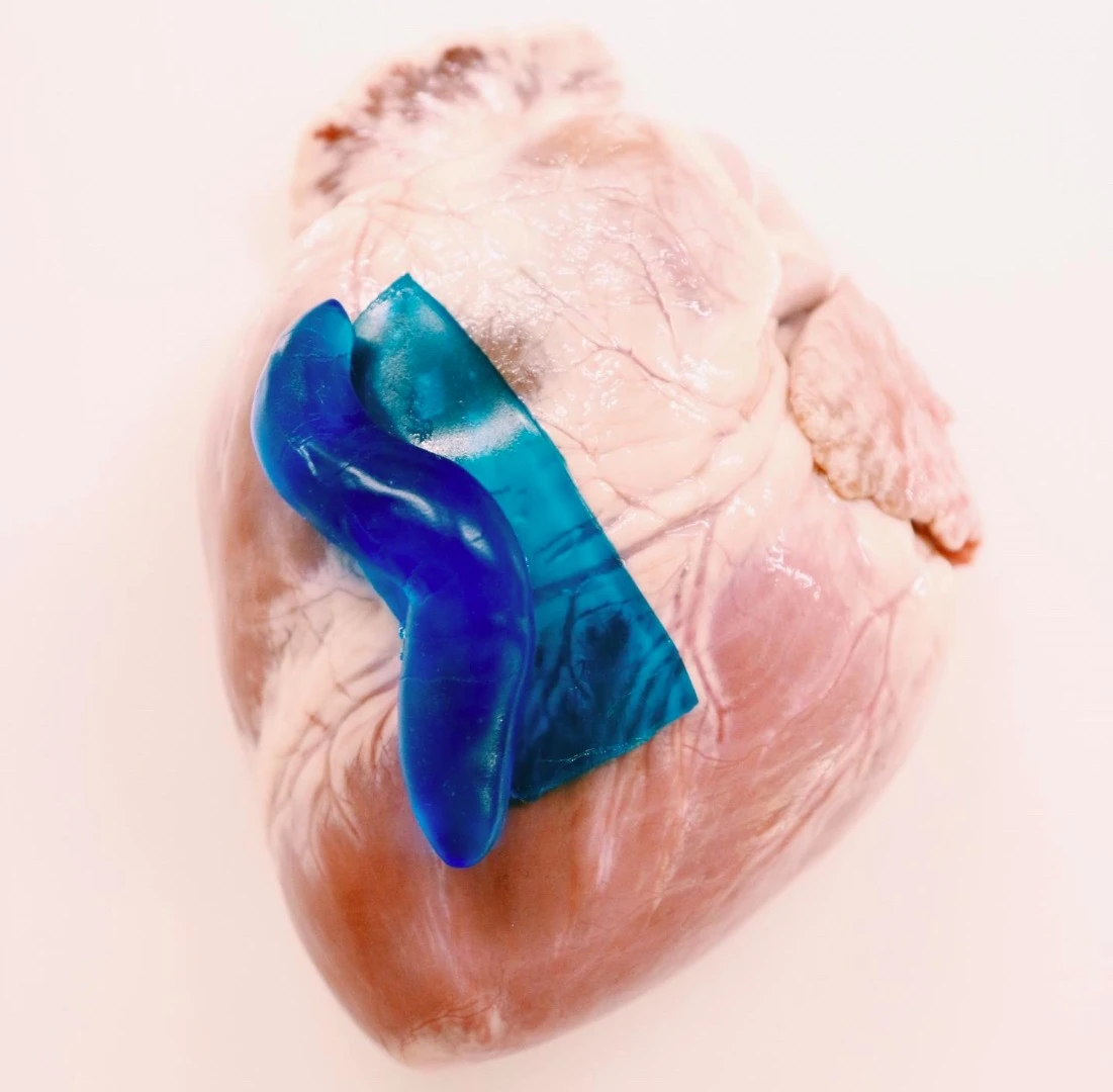 The tough adhesive can be formed into either sheets (teal blue) or custom shapes (dark blue)