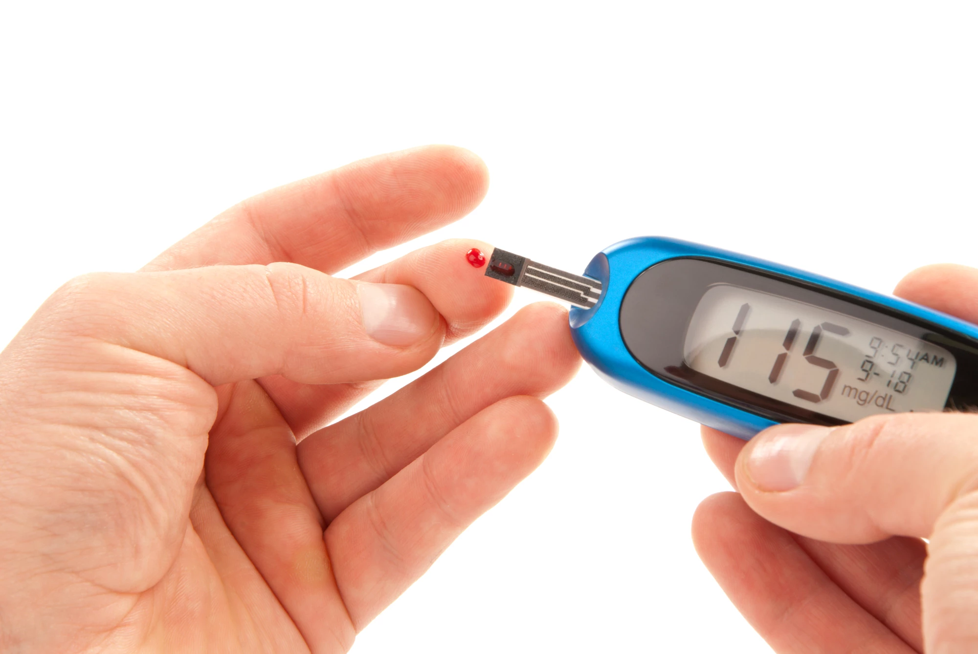A gene previously associated with leukemia has been strongly associated with impaired insulin production in type 2 diabetics