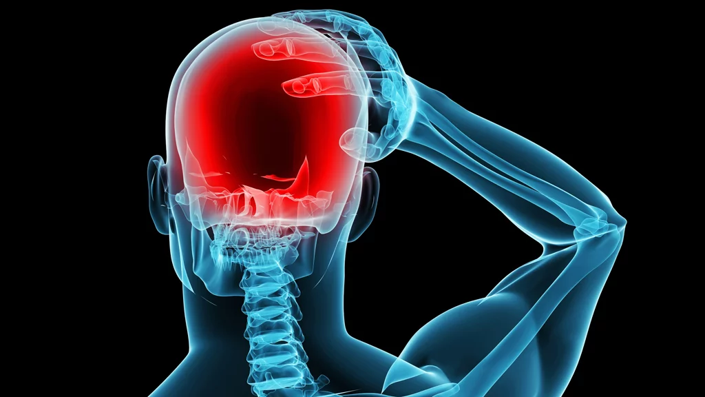 A new study has shown that transcranial direct current stimulation (tDCS) can prevent migraines from occurring (Image: Shutterstock)