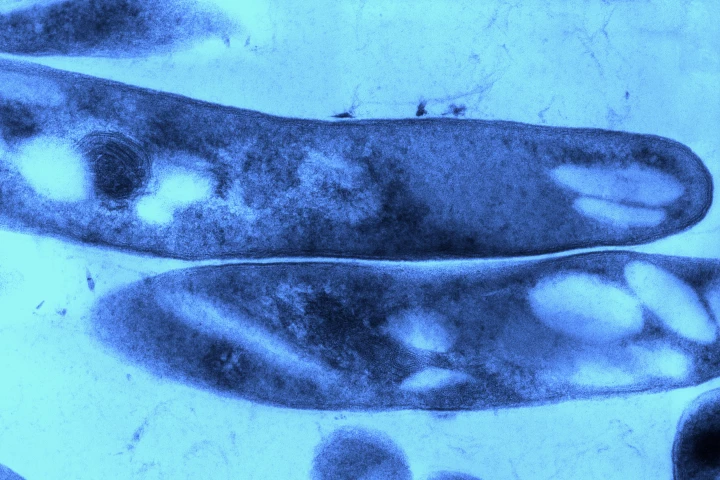 The blood test checks for a telltale protein produced by tuberculosis-causing Mycobacterium tuberculosis (pictured)