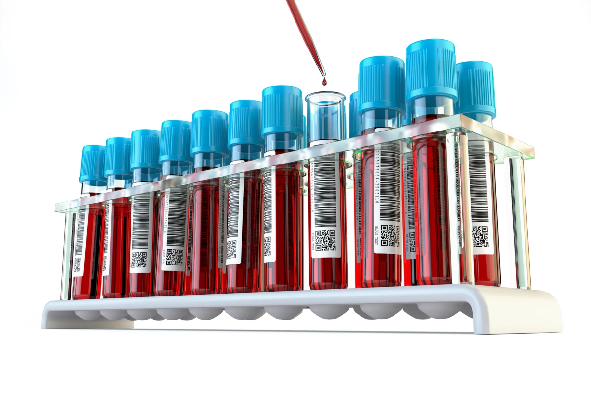 A UC San Diego study has found evidence that high levels of a specific type of exRNA in blood samples predicts the onset of Alzheimer's two years before symptoms appear