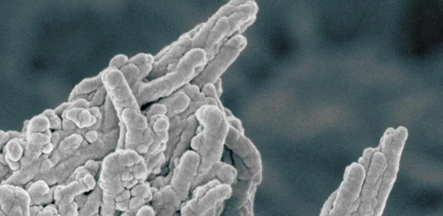 Uncovering the mechanism by which calcium deposits accumulate on the walls of arteries could help develop new treatments for everything from heart disease to dementia