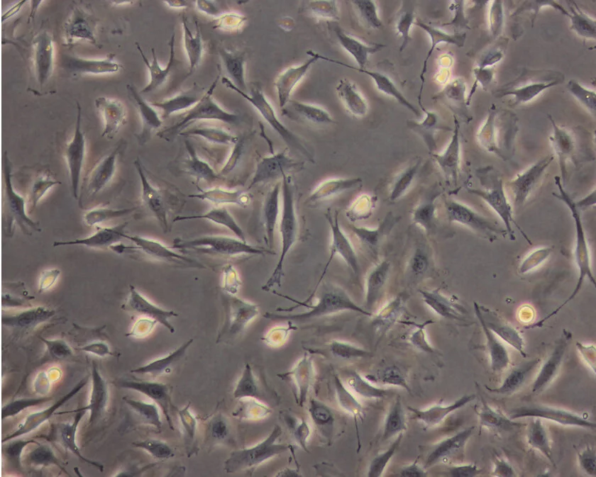 Endothelial cells in zero gravity formed themselves into globules and tubes