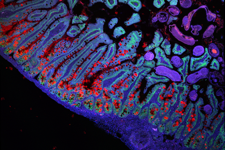 The human small intestine