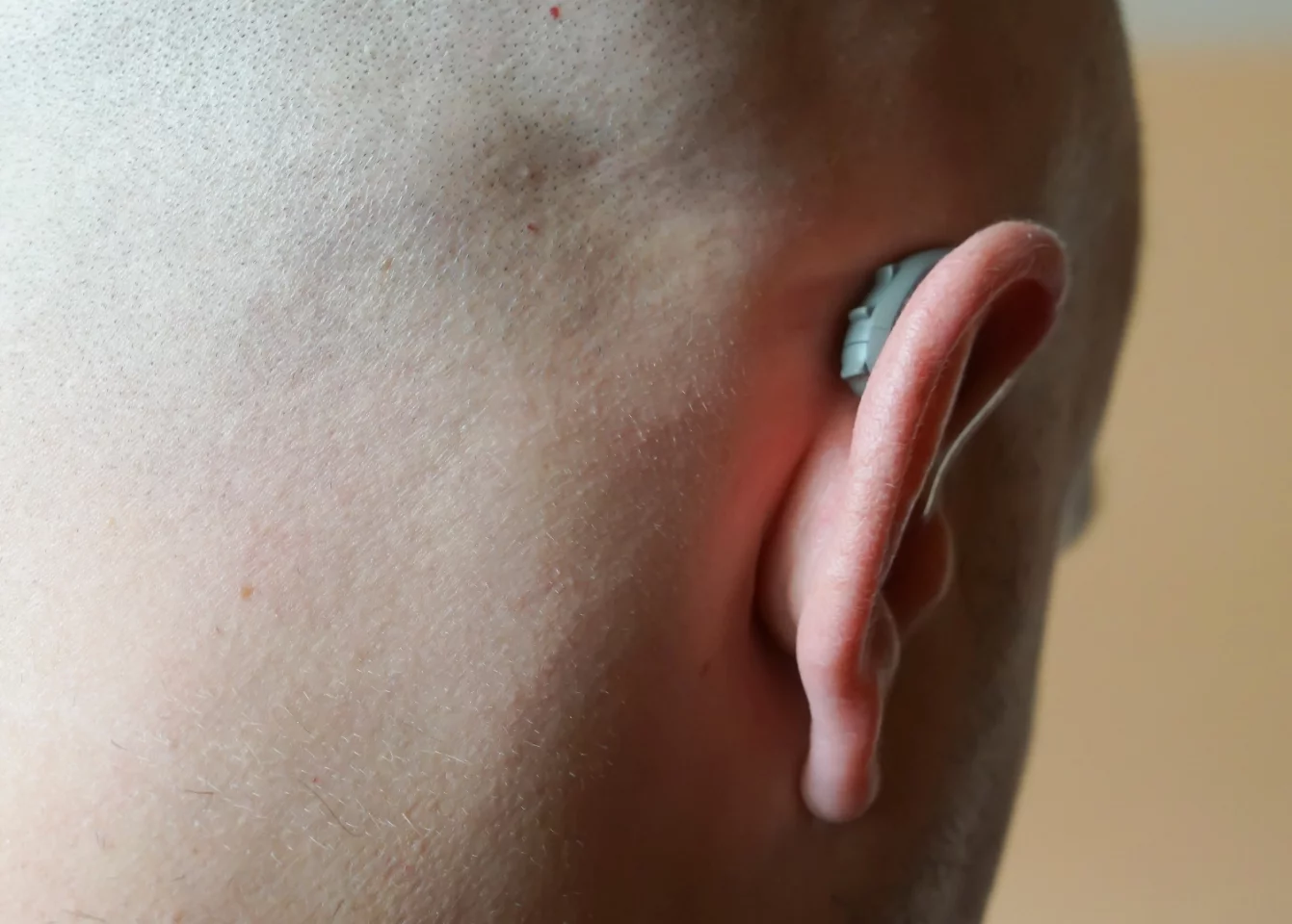 The device itself, tucked behind ear, sticks out more on a bald head than it will one with hair