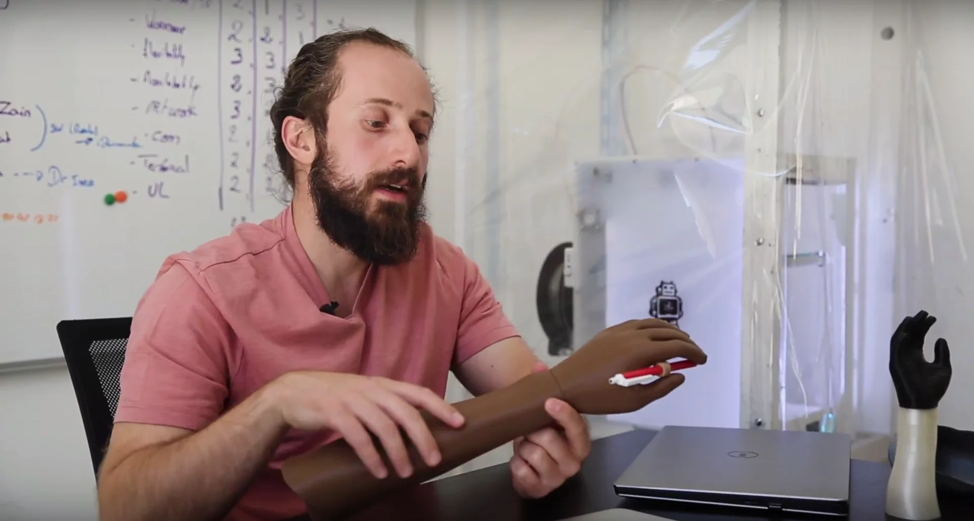 MSF's Safa Herfat demonstrates a US$20 3D-printed hand