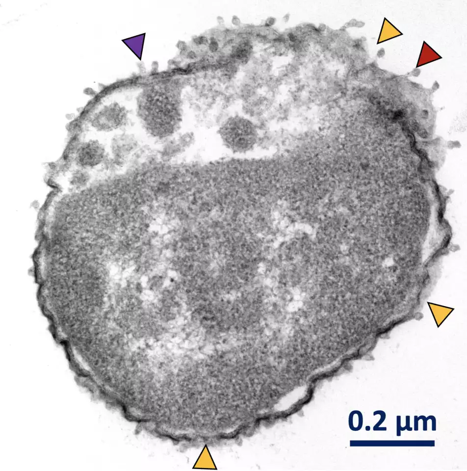 A microscope image of Klebsiella pneumoniae after being targeted by molecular drills. The insides of the bacteria are leaking out at the red arrow