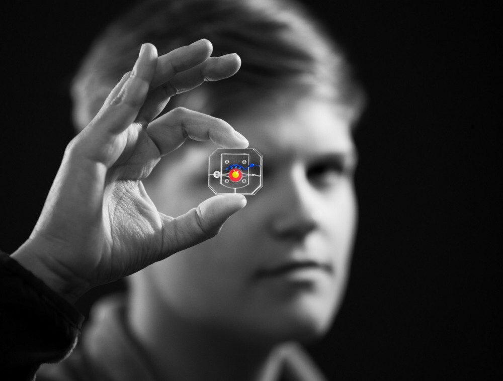 Graduate student Rachel Young holds up the new eye-on-a-chip device