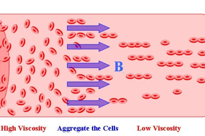A diagram depicting Tao's system for thinning blood using magnetic fields (Image: Temple University)