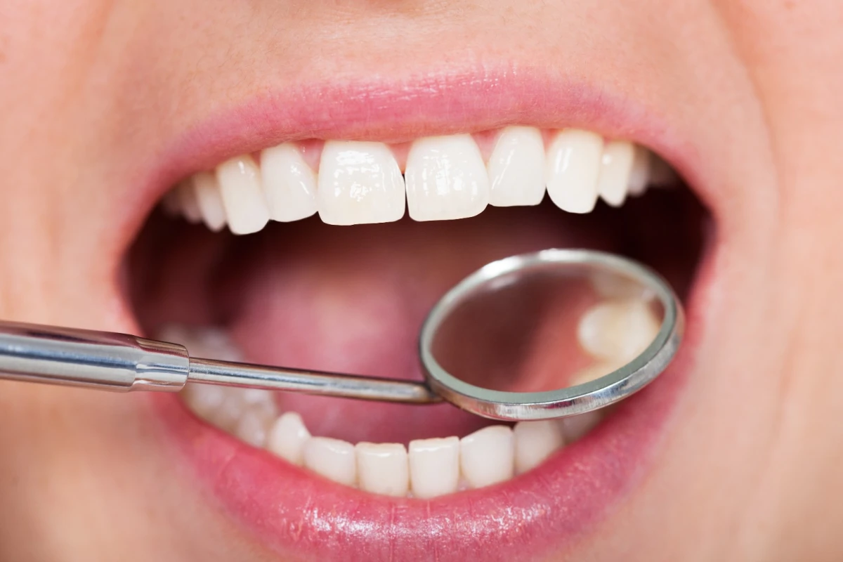 Graphene could be used to fill cavities in the future