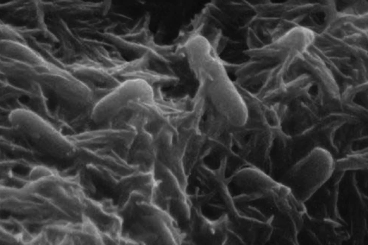 Shewanella bacteria, which produces ketones that are processed into fuel(Image from 'Cultivating Bacteria's Taste for Toxic Waste')