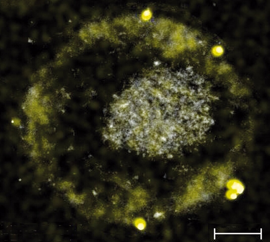 The C. metallidurans bacteria, along with some of the tiny gold nuggets it excretes