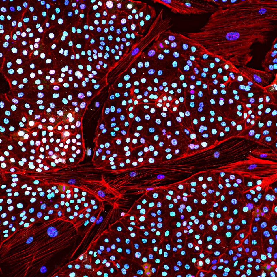 Colonies of Asian elephant induced pluripotent stem cells (iPSCs), created by Colossal Biosciences in a breakthrough towards resurrecting the woolly mammoth