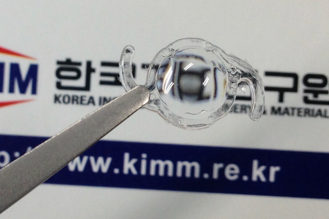 The lens could be implanted behind the cornea of people known to be at risk of Alzheimer's