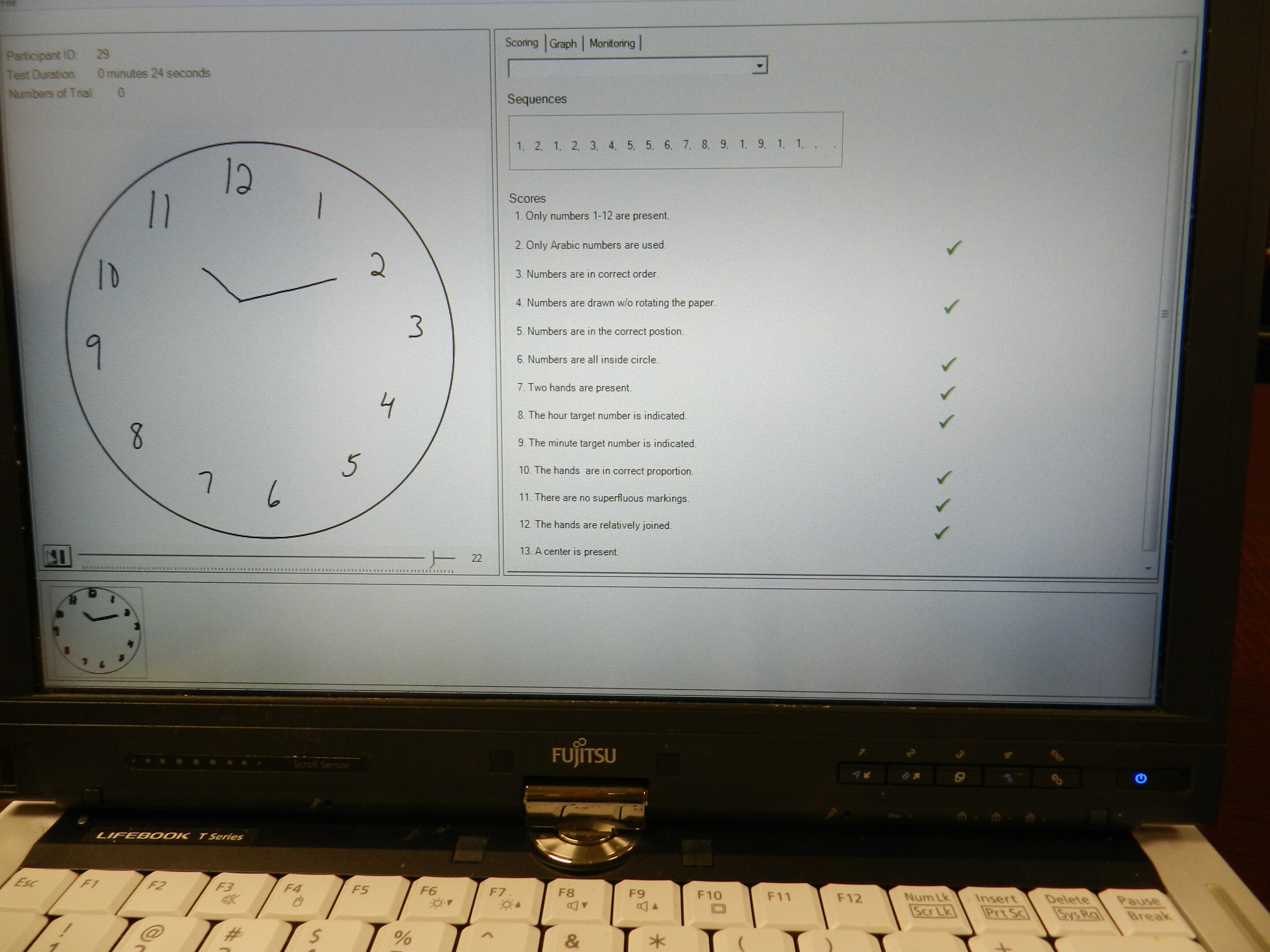 Clock Drawing Test goes digital for early diagnosis of Alzheimer’s disease
