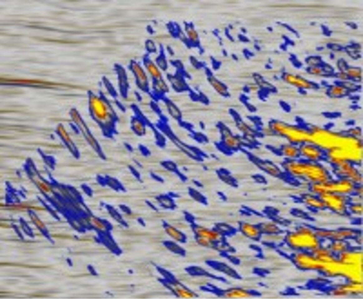 An Acoustic Zoom image