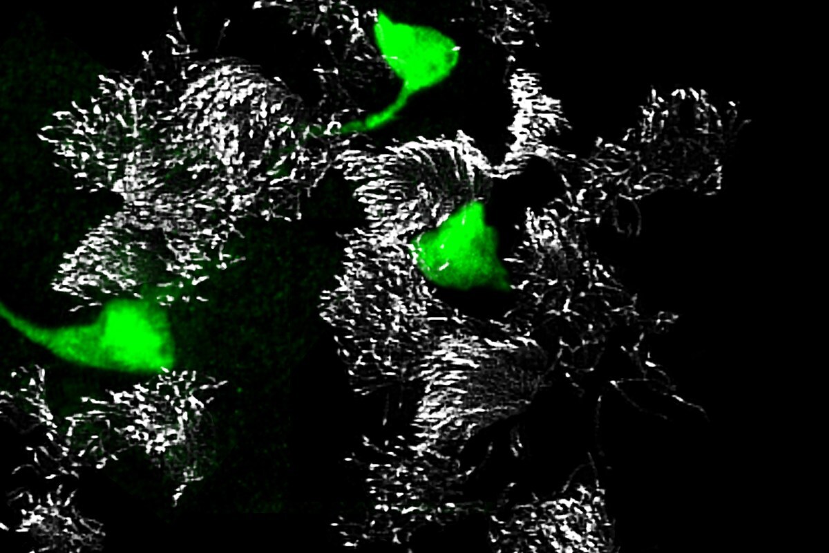 Pulmonary ionocytes (green) appear to express high levels of the gene CFTR, mutations of which can cause cystic fibrosis