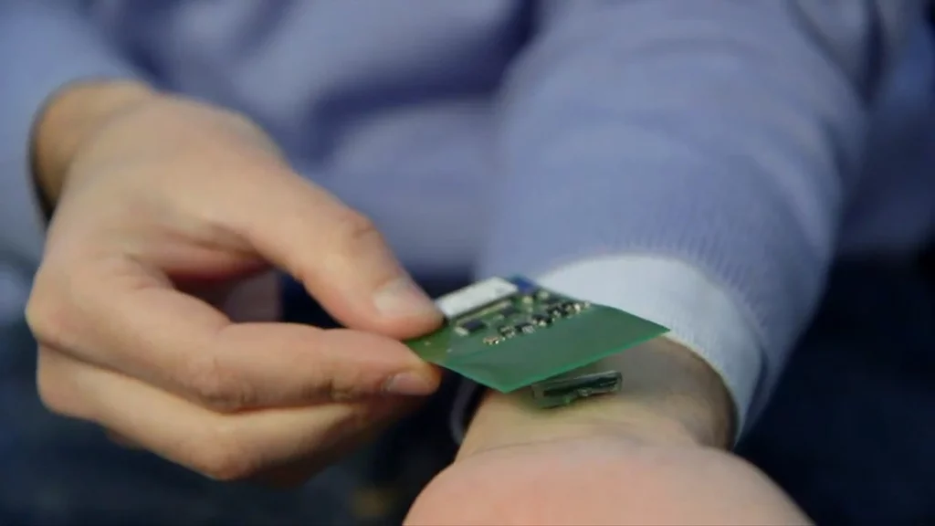 The implant is powered by and transmits data to a patch outside the body
